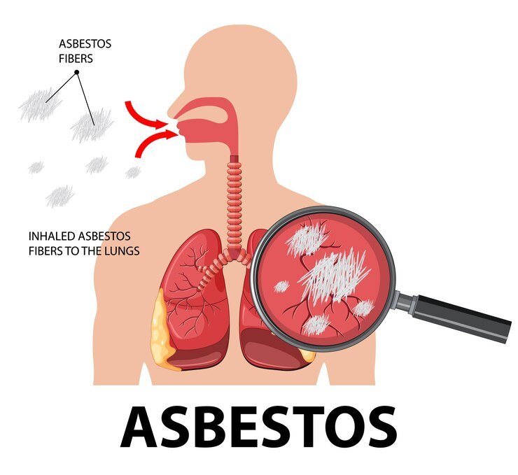 The Importance of an Asbestos Management Survey in London